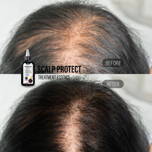 
                
                    Load image into Gallery viewer, Scalp Protect (Treatment Essence)
                
            
